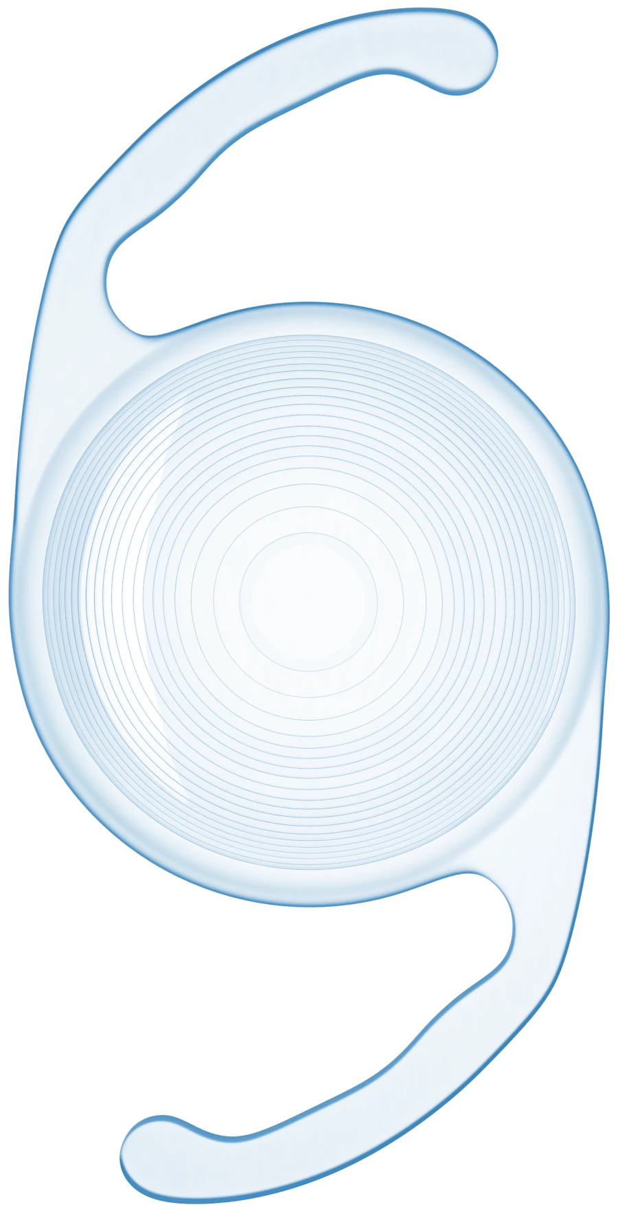 Intraocular polymer bifocal lens MIOL-ACORD