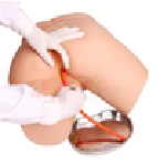 Model for enema 15B