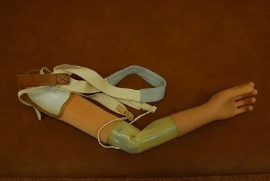 Active shoulder prosthesis