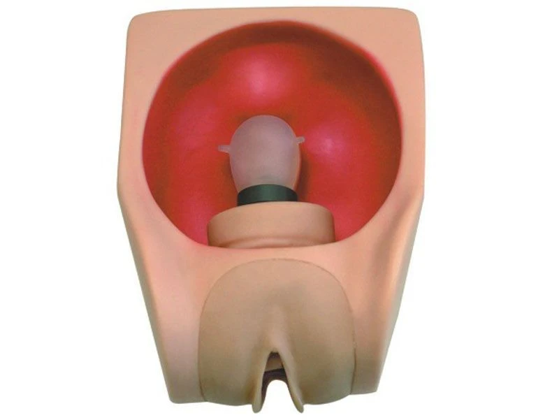 Advanced female contraceptive model, T34B
