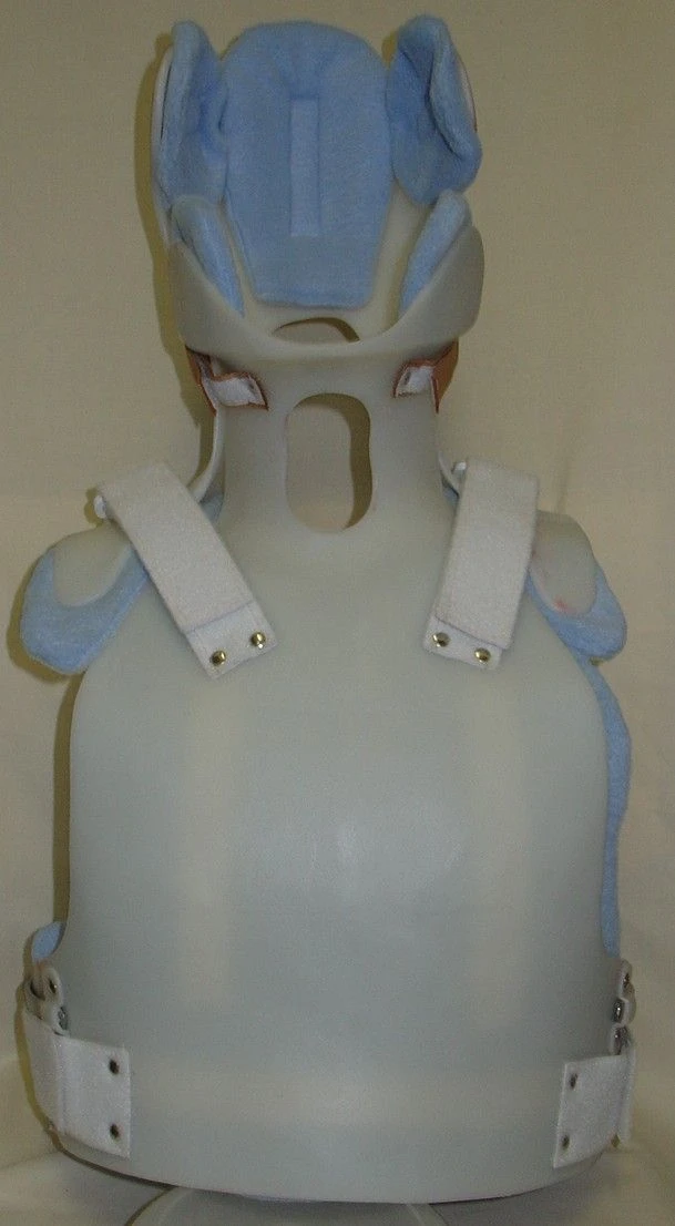 Head holder of rigid fixation