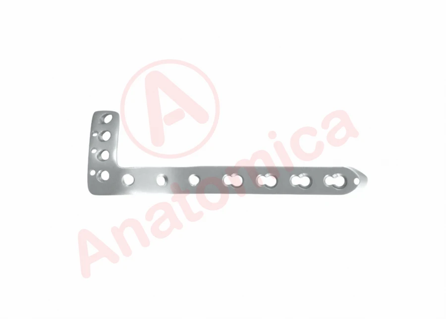 L-shaped tibial plate with angular stability with limited contact
