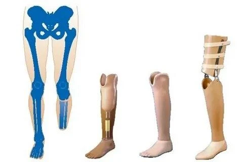 Therapeutic and training tibia prosthesis