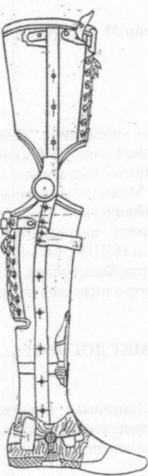 Non-modular tibial prosthesis, including for congenital malformations