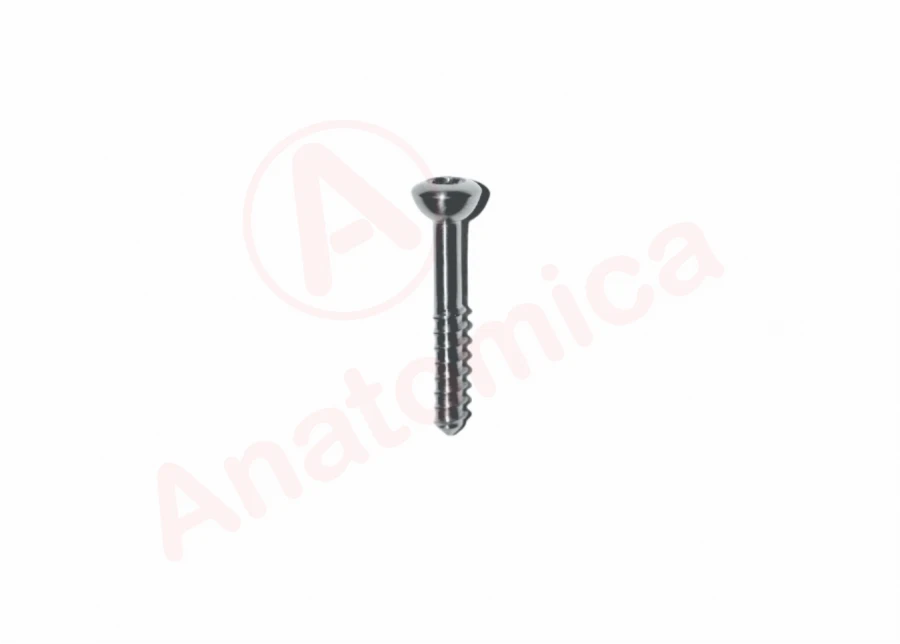 Tie rod screw