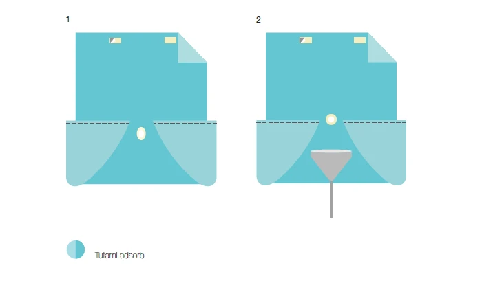 Disposable surgical sterile sheet 1600/2700x2800MM