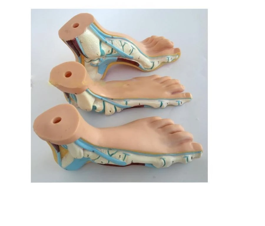 Foot Model (Normal Foot, Flat Foot, Vaulted Foot), 11310