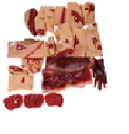 Trauma and injury kit G110-43