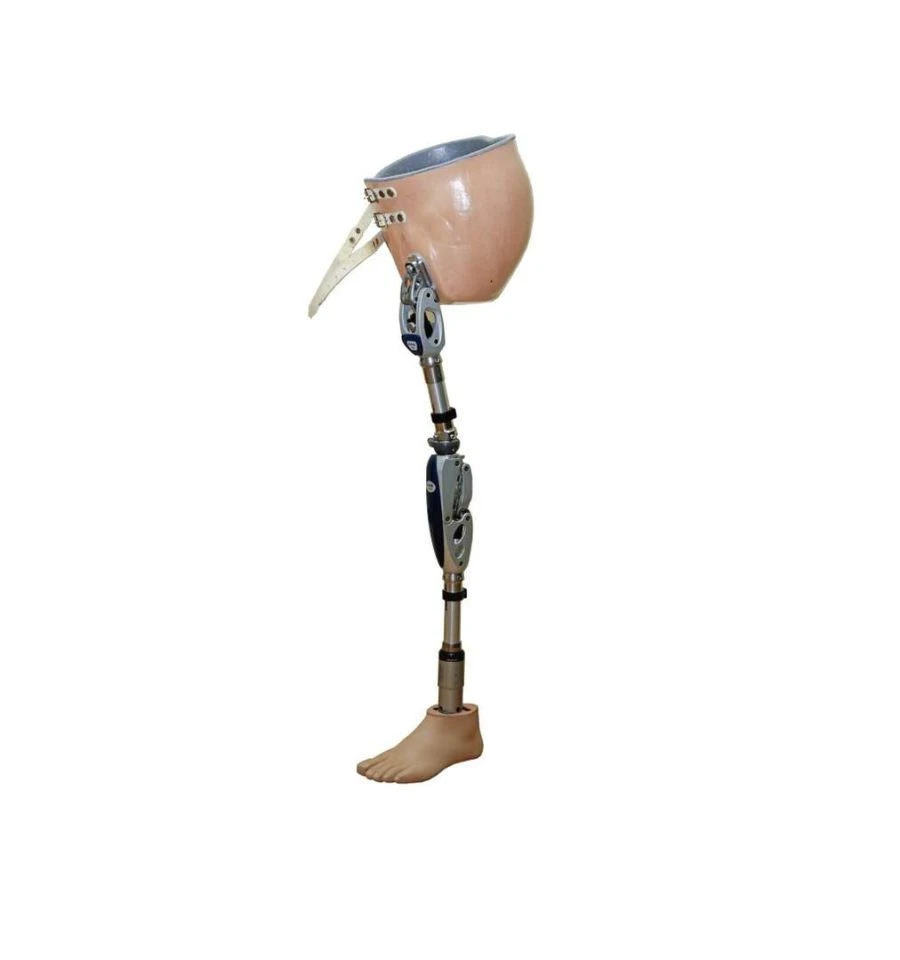 Modular prosthesis for hip dislocation