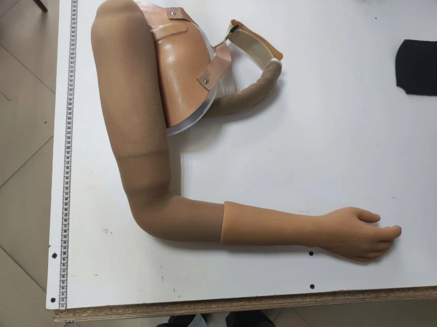 Functional-cosmetic prosthesis after shoulder dislocation