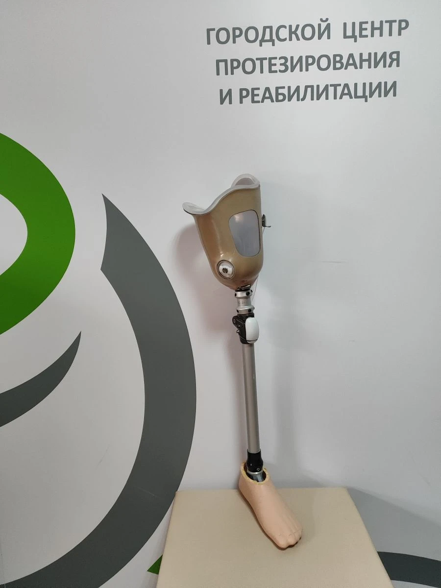Modular hip prosthesis, including for congenital underdevelopment