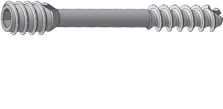 Cannulated compression screws Ø 4.0/5.0 mm, length 30 mm to 75 mm, 5 mm pitch, Nos. 419.0XX