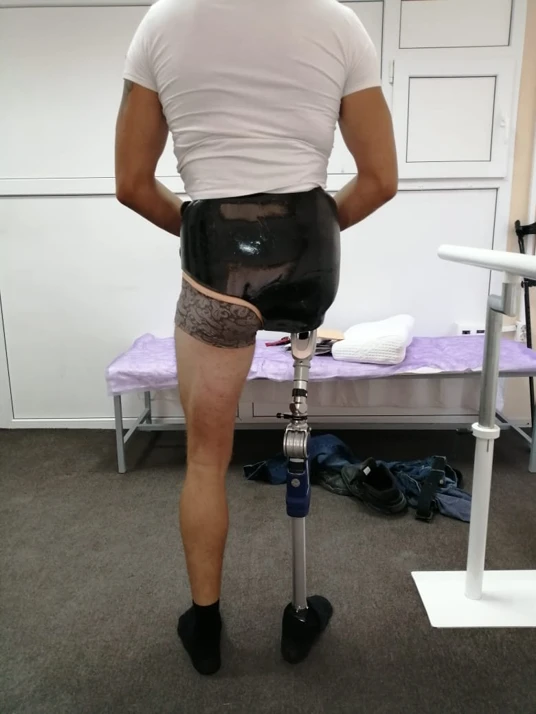 Modular prosthesis for hip dislocation