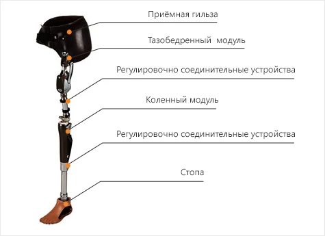 Modular microprocessor-controlled hip dislocation prosthesis
