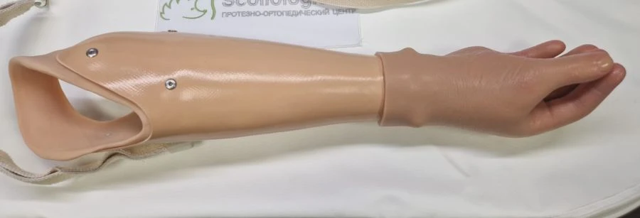 Active (traction) forearm prosthesis