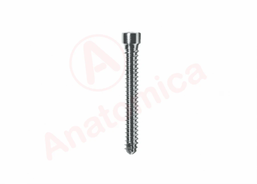 Distal locking screw