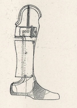 Chopard (Lisfranc) foot prosthesis PN0-06-03