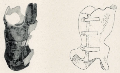 Functional-corrective corset for the thoracolumbar spine of the Chenault type KR4Sh