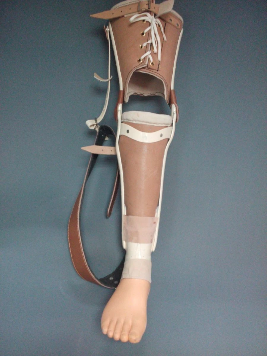 Non-modular tibial prosthesis