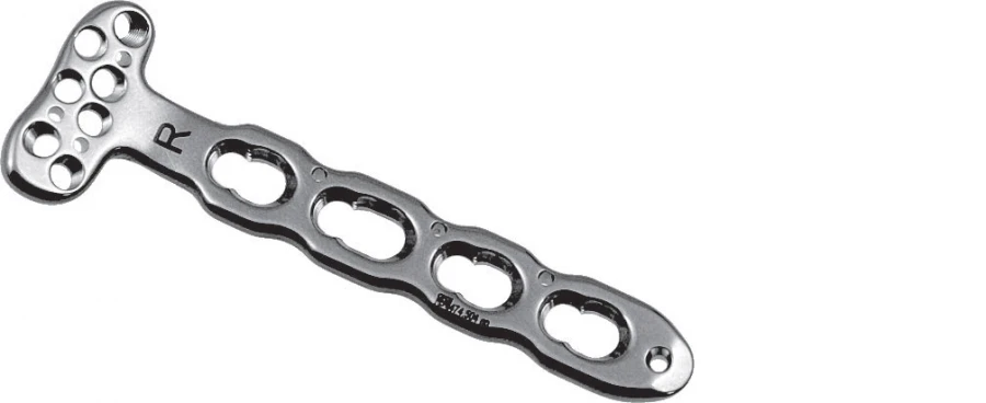 Distal radial plates RS 2,4/3,5, left and right, part no. 474.5XX R/L