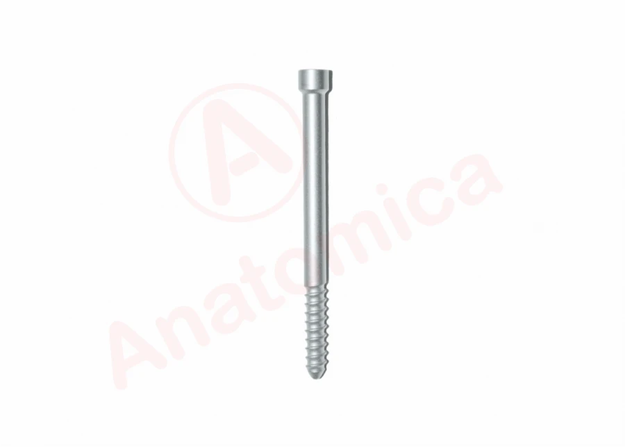 Proximal locking screw