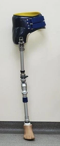 Modular prosthesis for hip dislocation