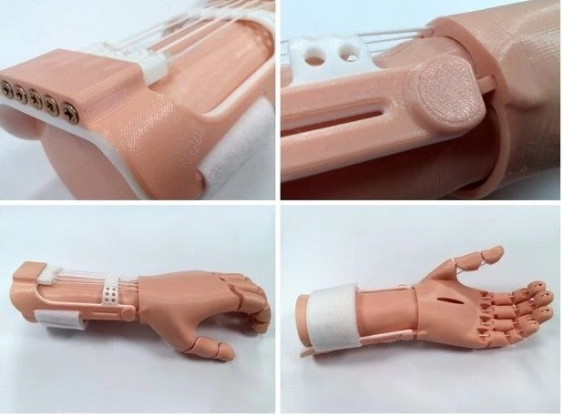 Active (traction) prosthesis of the hand, including partial dislocation and partial dislocation of the hand PR0-T-OK