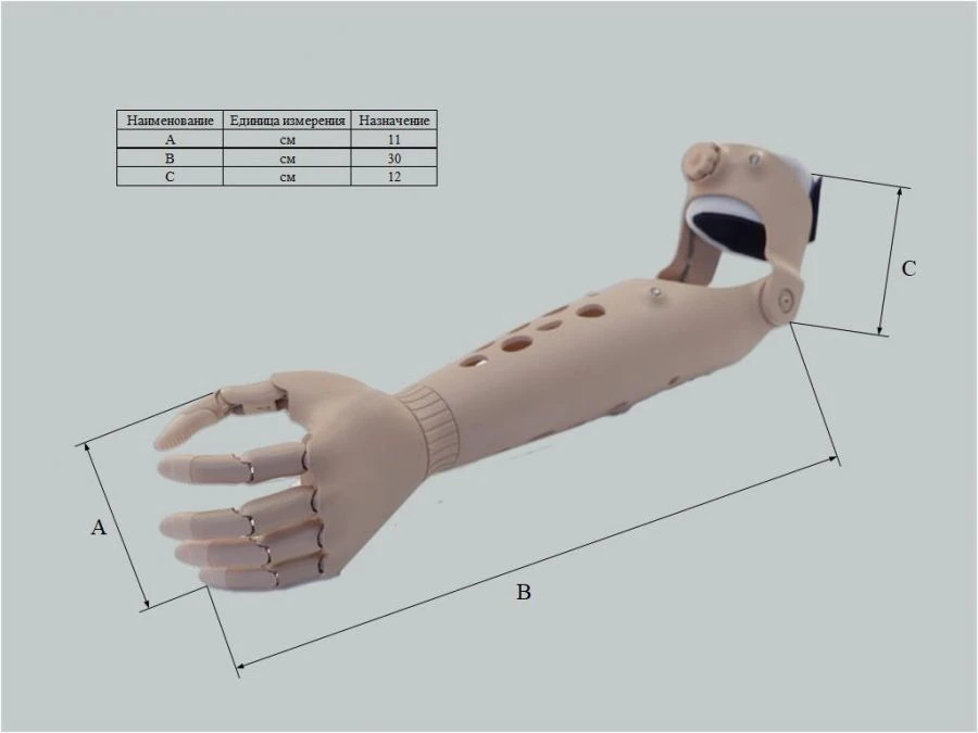 Microprocessor-controlled wrist prosthesis, including separation and partial separation of the hand.