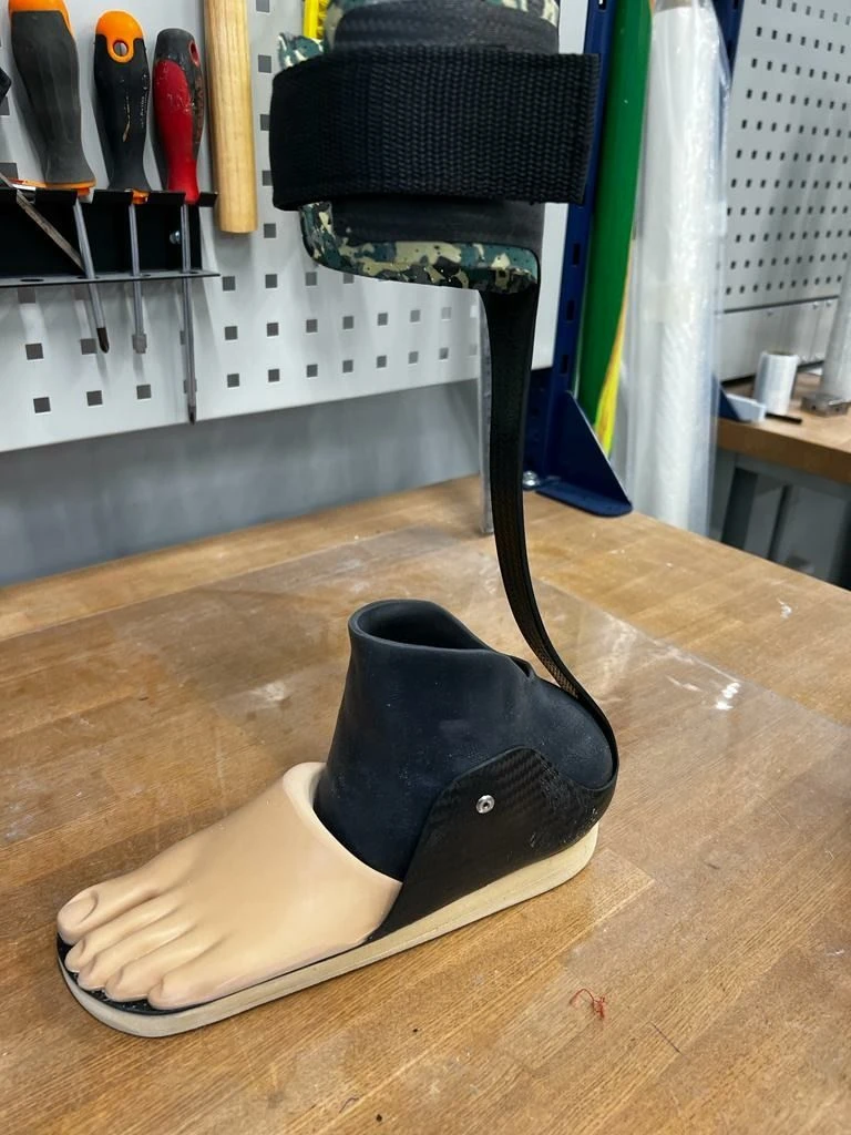Chopar prosthesis of the foot
