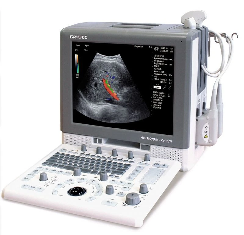 Portable ultrasound machine ANGIODIN-Sono/P-ultra