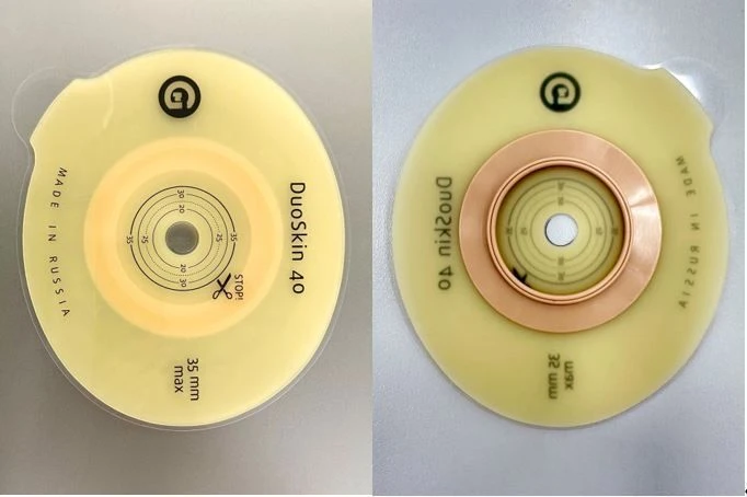 Rehabilitation device for stomical use in colostomies, ileostomies and urostomies: flat plate, convex plate.