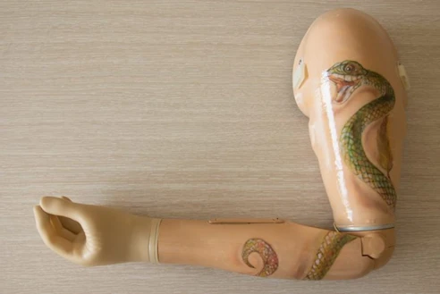 Shoulder prosthesis with microprocessor control system