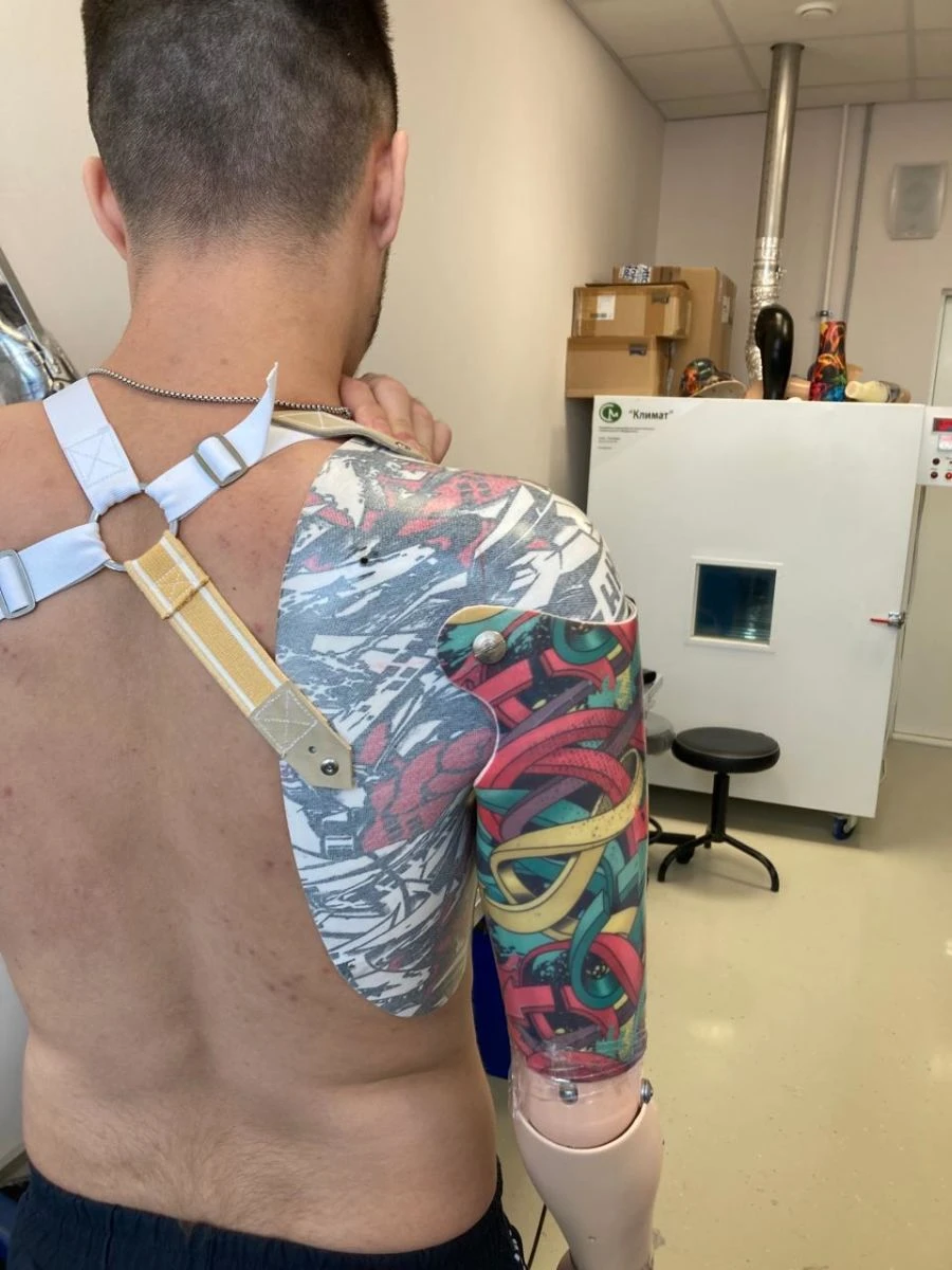 Prosthesis after shoulder dislocation with microprocessor control PR8-MBO