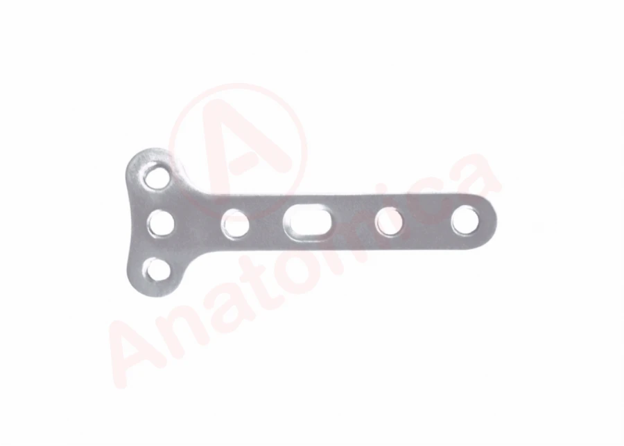 Small T-plate with angular stability