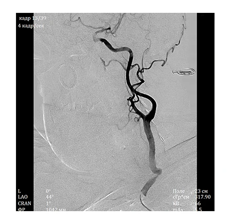Detector & Imaging Chain