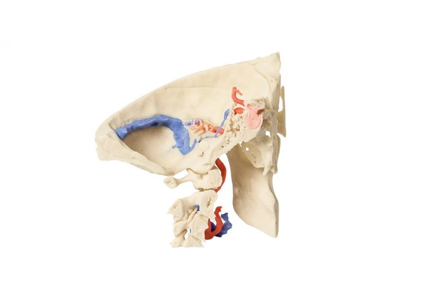Expanded temporal bone model, 11119