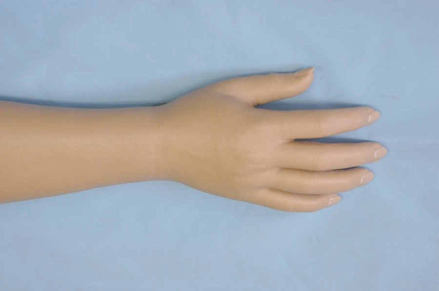Cosmetic hand prosthesis, including partial and partial dislocation of the hand PR0-21