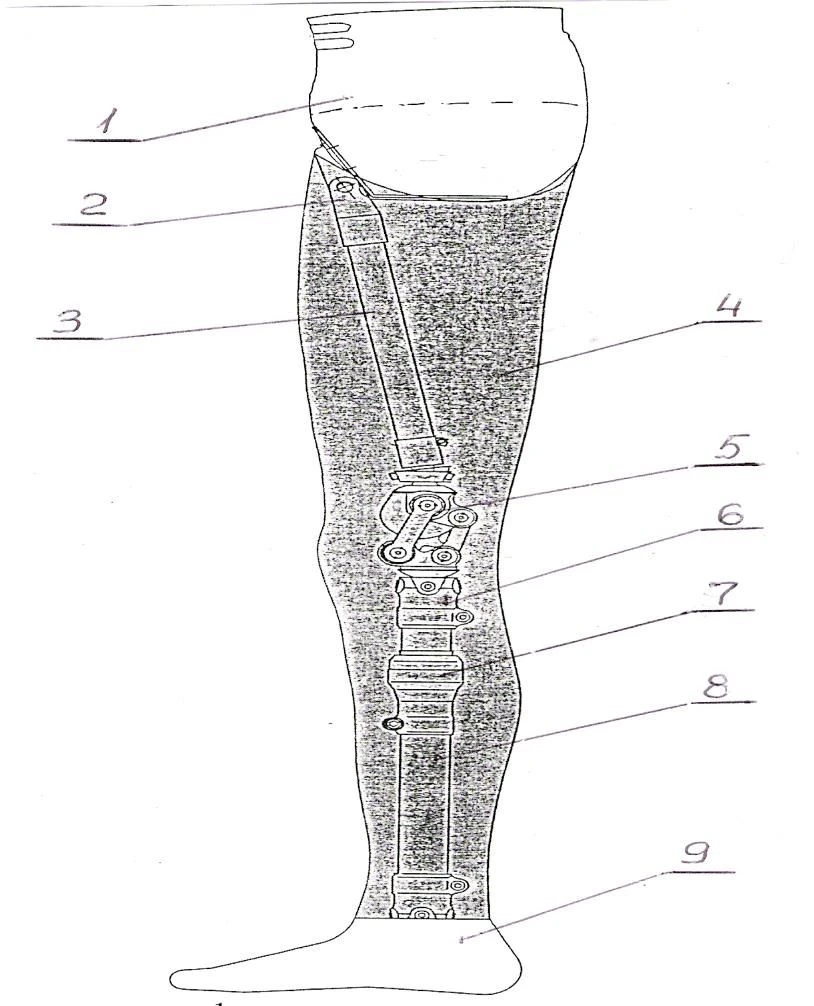 Modular prosthesis for hip dislocation