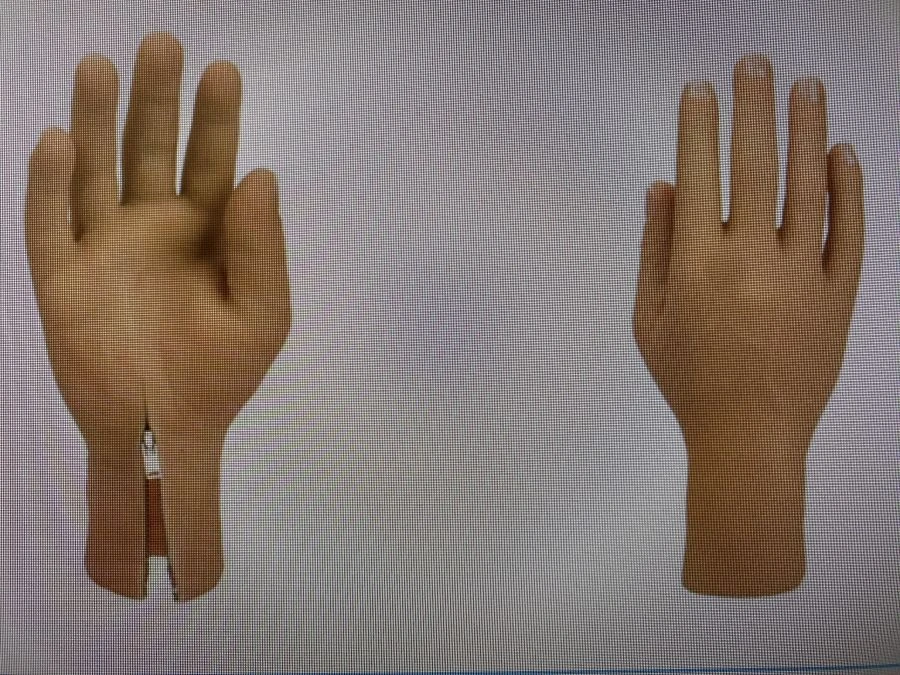 Cosmetic prosthesis of the hand, including partial and partial dislocation of the hand
