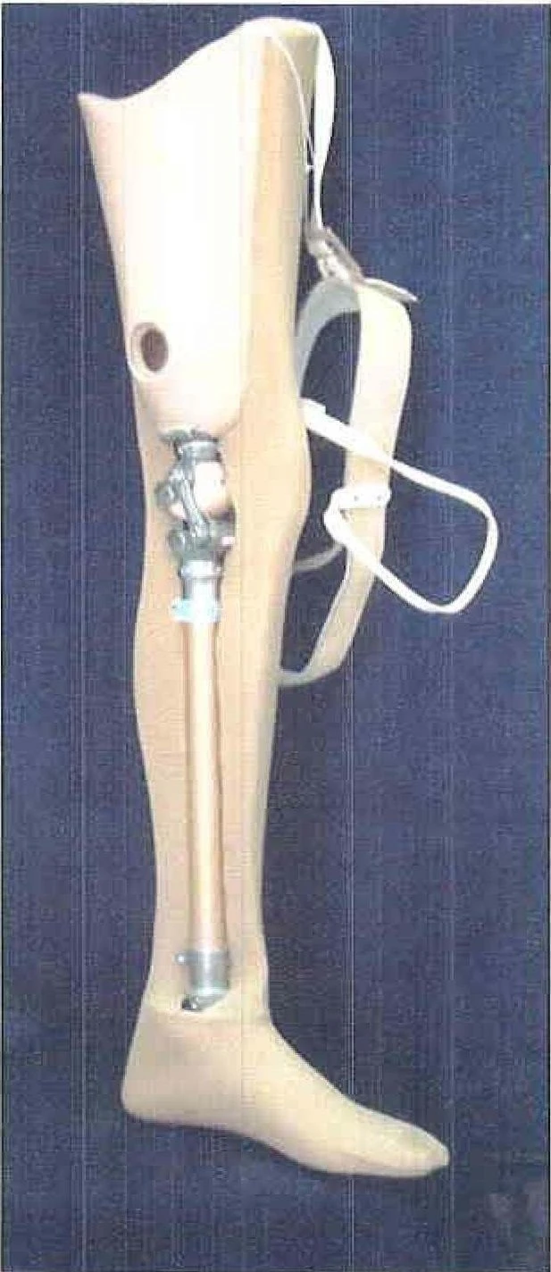 Modular hip prosthesis, including those with congenital underdevelopment PH6-03-OC