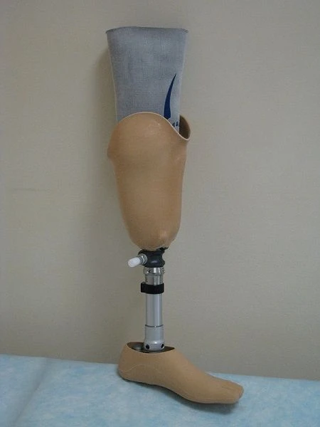 Modular tibial prosthesis, including those with underdevelopment