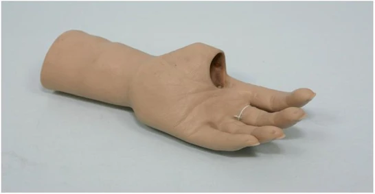 Cosmetic prosthesis of the hand, including partial and partial dislocation of the hand
