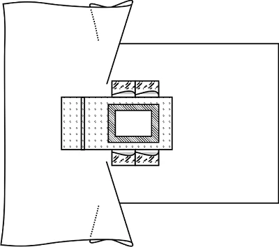 Sheet for limitation of the operating field (surgical covering) of the abdominal-promesenteric region, sterile