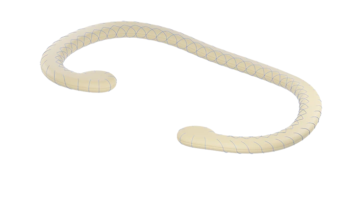 Support rings for anuloplasty according to TU 9444-012-57628698-2007. Tricuspidal