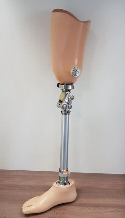 Modular hip prosthesis, including for congenital underdevelopment