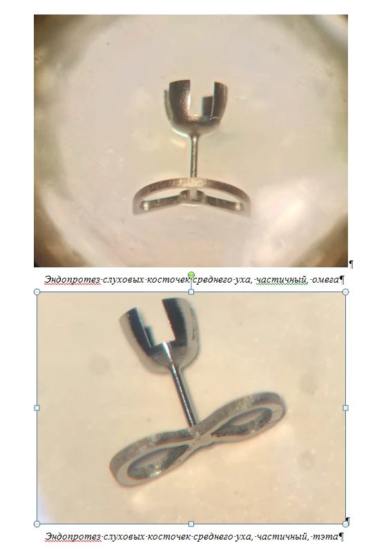 Endoprostheses of the auditory ossicles of the middle ear, ESC-"CONMET", partial according to TU 32.50.22-030-11458417-2021