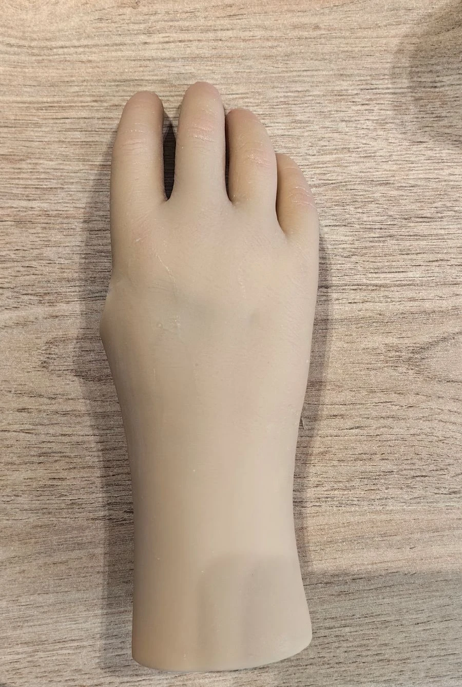 Cosmetic prosthesis of the hand, including partial and partial dislocation of the hand