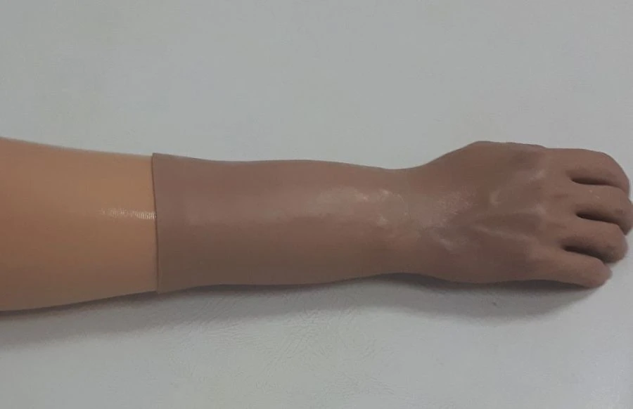 Cosmetic forearm prosthesis