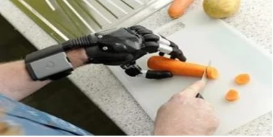 Microprocessor-controlled wrist prosthesis, including separation and partial separation of the hand.