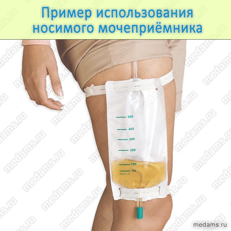 Example of use